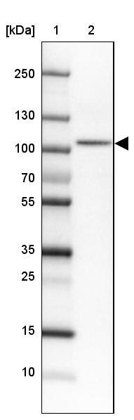 Lane 1: Marker [kDa]Lane 2: Human cell line HEL
