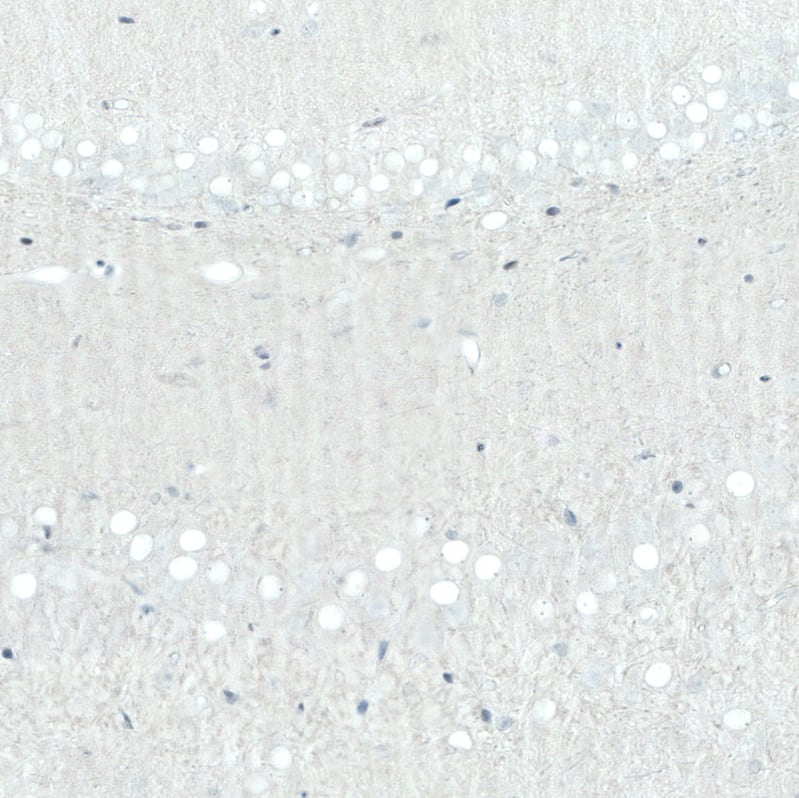 Staining of rat hippocampus shows no positivity in neurons in the dentate gyrus as expected.