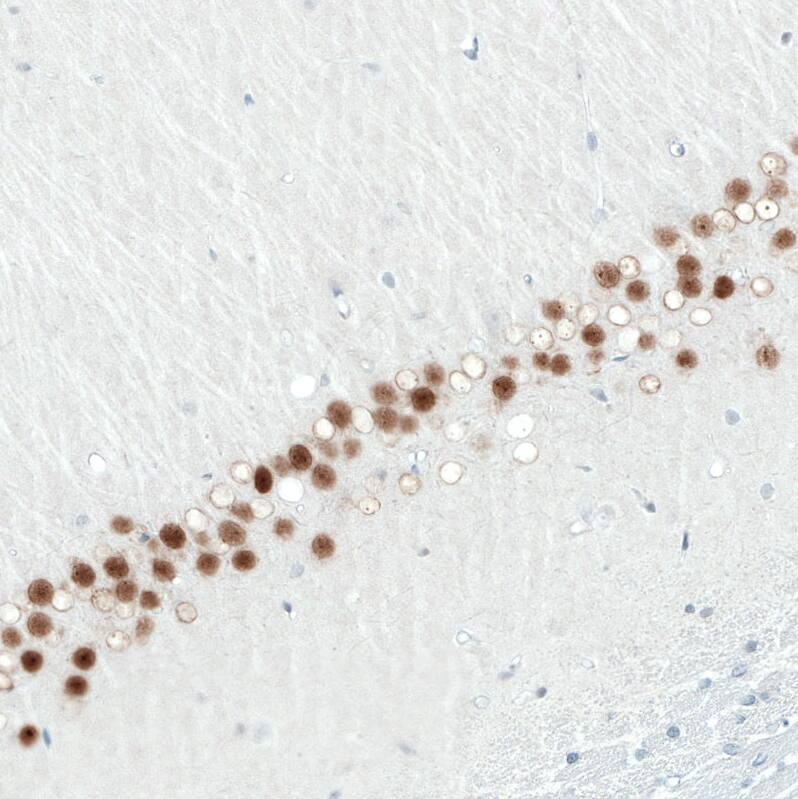 Staining of rat hippocampus shows moderate to strong nuclear positivity in CA1 layer neurons.