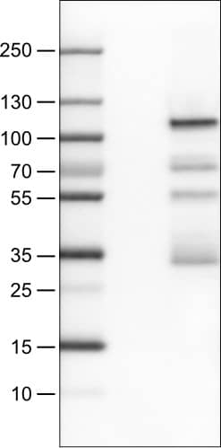 Lane 1: Marker [kDa]Lane 2: Negative control (vector only transfected HEK293T lysate) Lane 3: SATB2 Over-expression Lysate (Co-expressed with a C-terminal myc-DDK tag (~3.1 kDa) in mammalian HEK293T cells) 