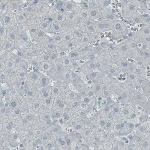 Staining of human liver shows absence of staining (negative control).