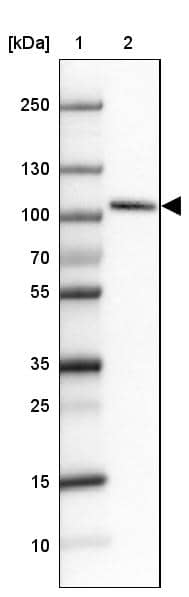 Lane 1: Marker [kDa]Lane 2: Human cell line HEL