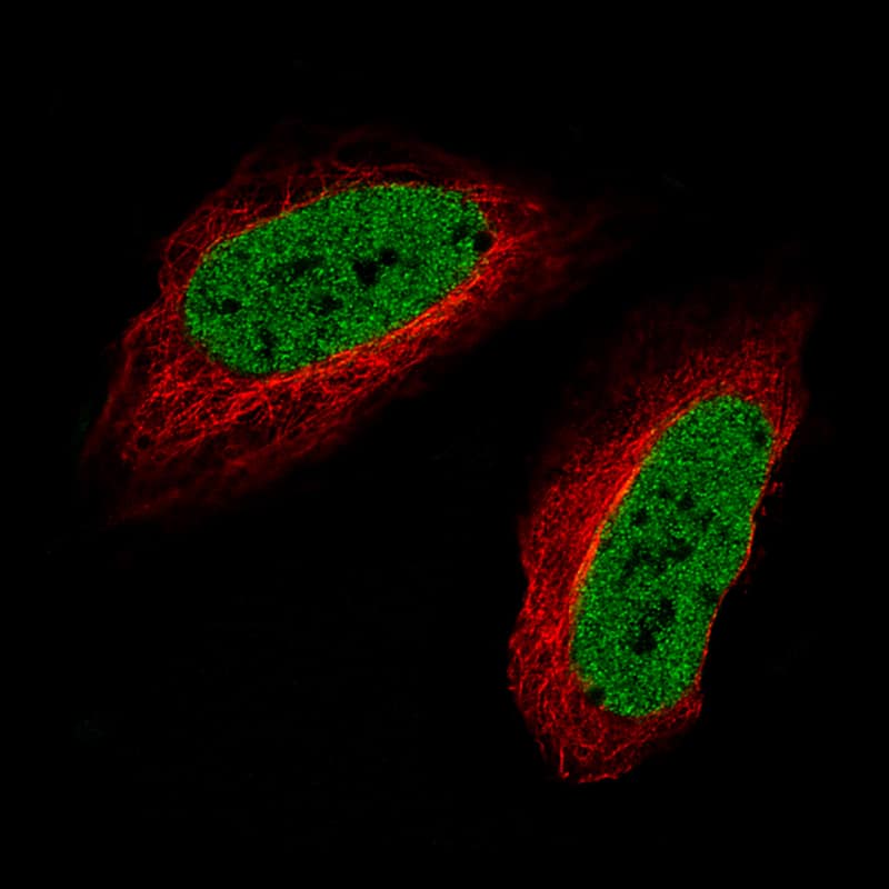 Staining of U-2 OS cells using the Anti-SATB2 monoclonal antibody) .
