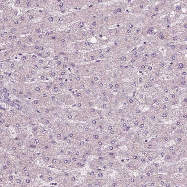 Staining of human liver shows no positivity in hepatocytes as expected.