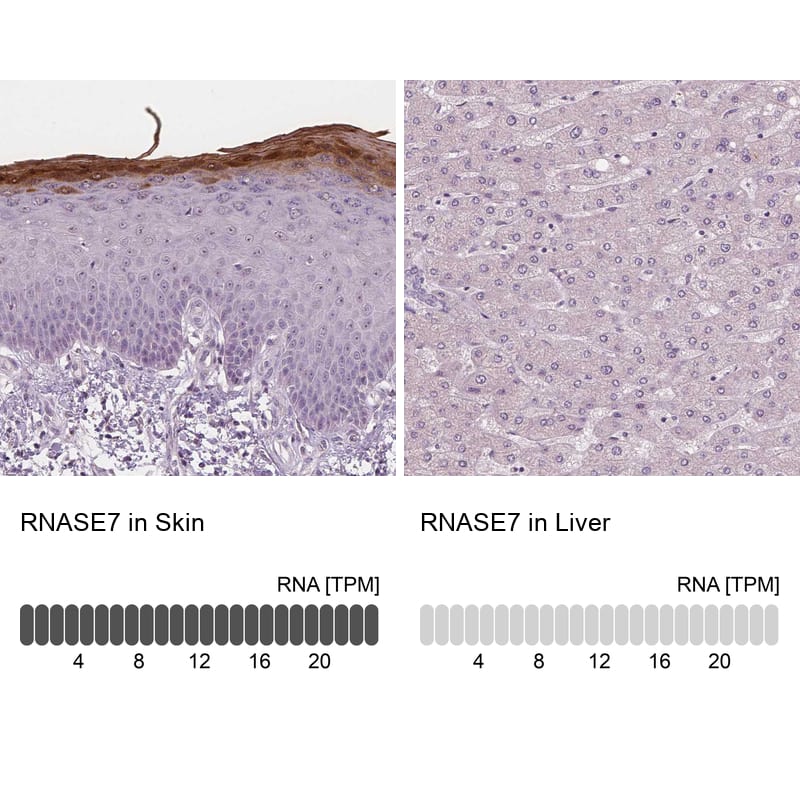 Analysis in human skin and liver tissues using NBP3-43952 antibody. Corresponding RNASE7 RNA-seq data are presented for the same tissues.