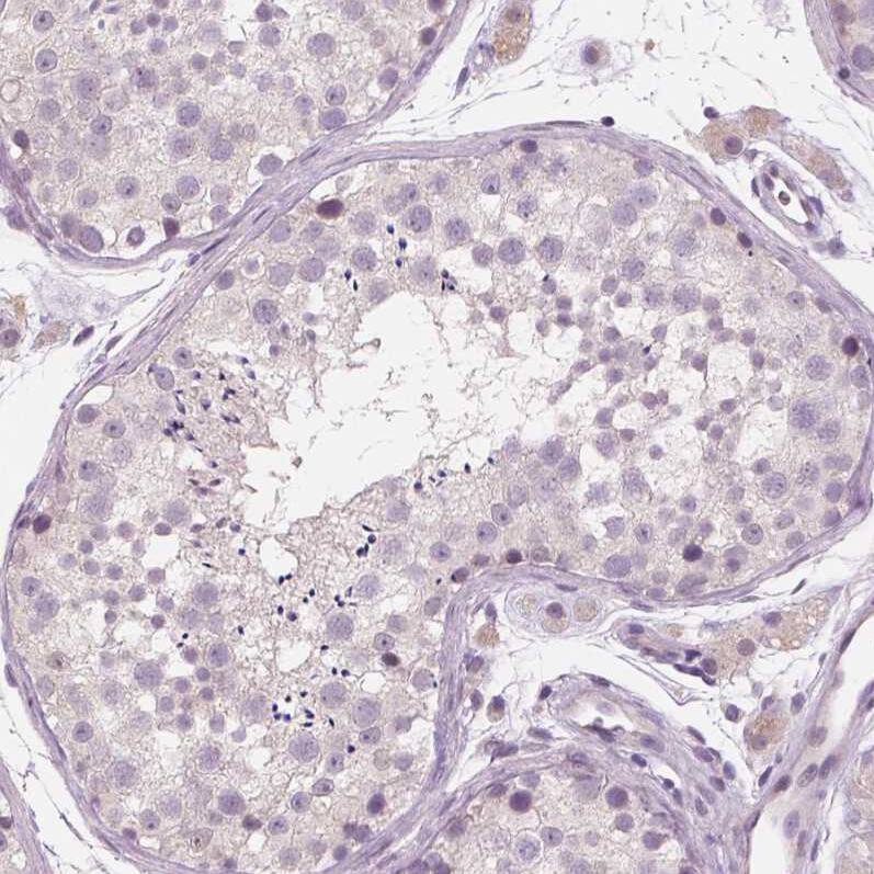 Staining of human testis shows no positivity in cells in seminiferous ducts as expected.