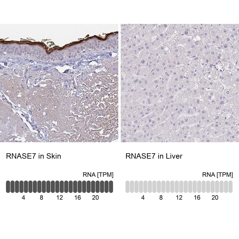 Analysis in human skin and liver tissues using NBP3-43953 antibody. Corresponding RNASE7 RNA-seq data are presented for the same tissues.