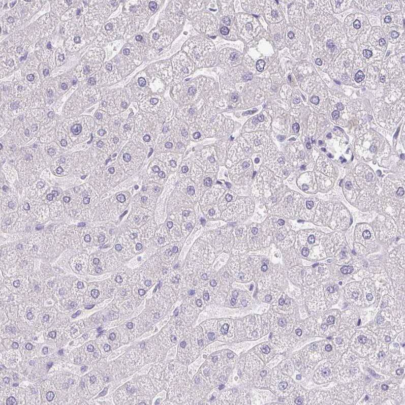 Staining of human liver shows no positivity in hepatocytes as expected.