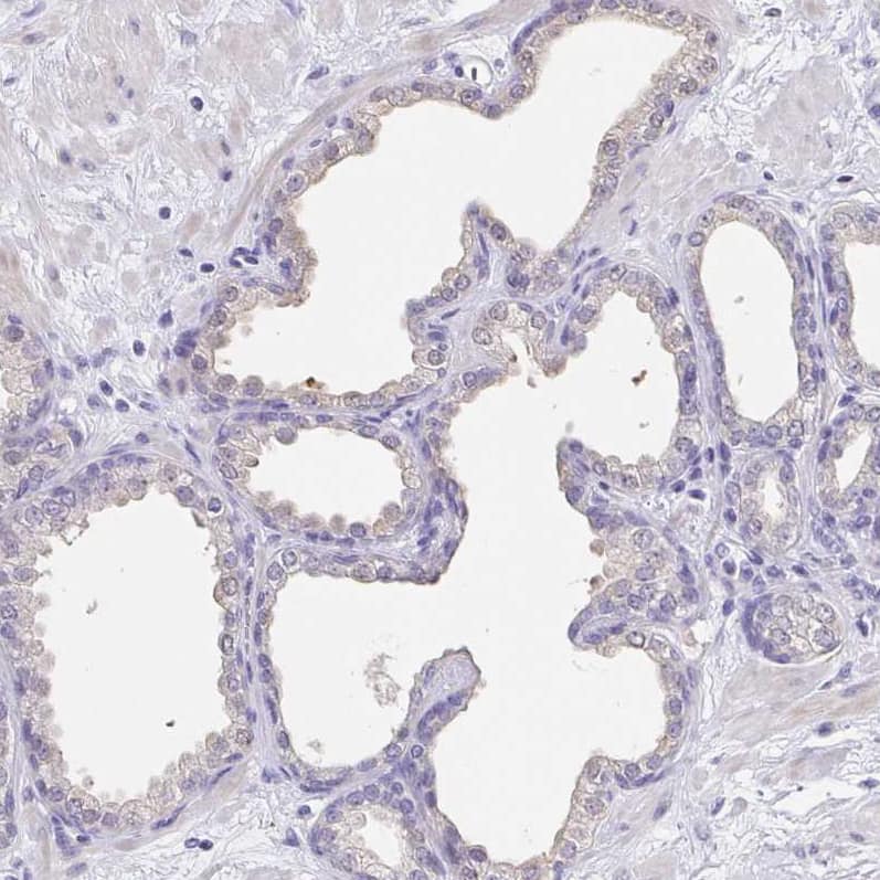 Staining of human prostate shows no positivity in glandular cells as expected.