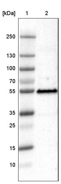 Lane 1: Marker [kDa]Lane 2: Human cell line U-251