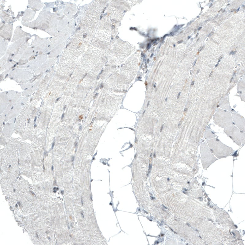 Staining of human skeletal muscle shows no nuclear positivity in striated muscle fibers as expected.