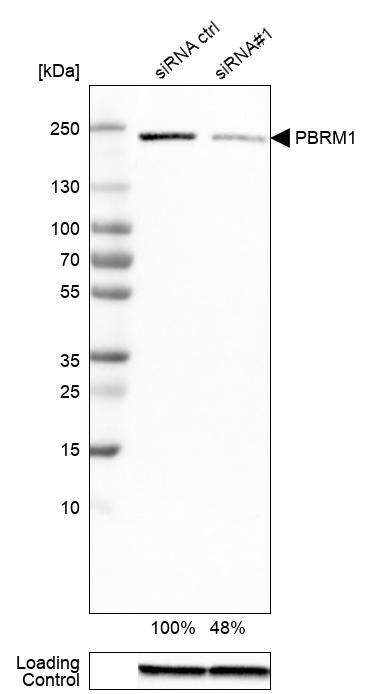 Analysis in RT-4 cells transfected with control siRNA, target specific siRNA probe #1, using Anti-BAF180/PB1 antibody. Remaining relative intensity is presented. Loading control: Anti-GAPDH.