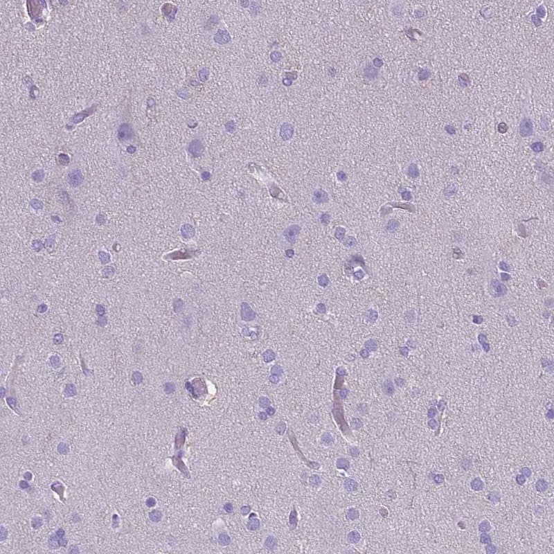 Staining of human cerebral cortex shows no positivity in neuronal cells as expected.