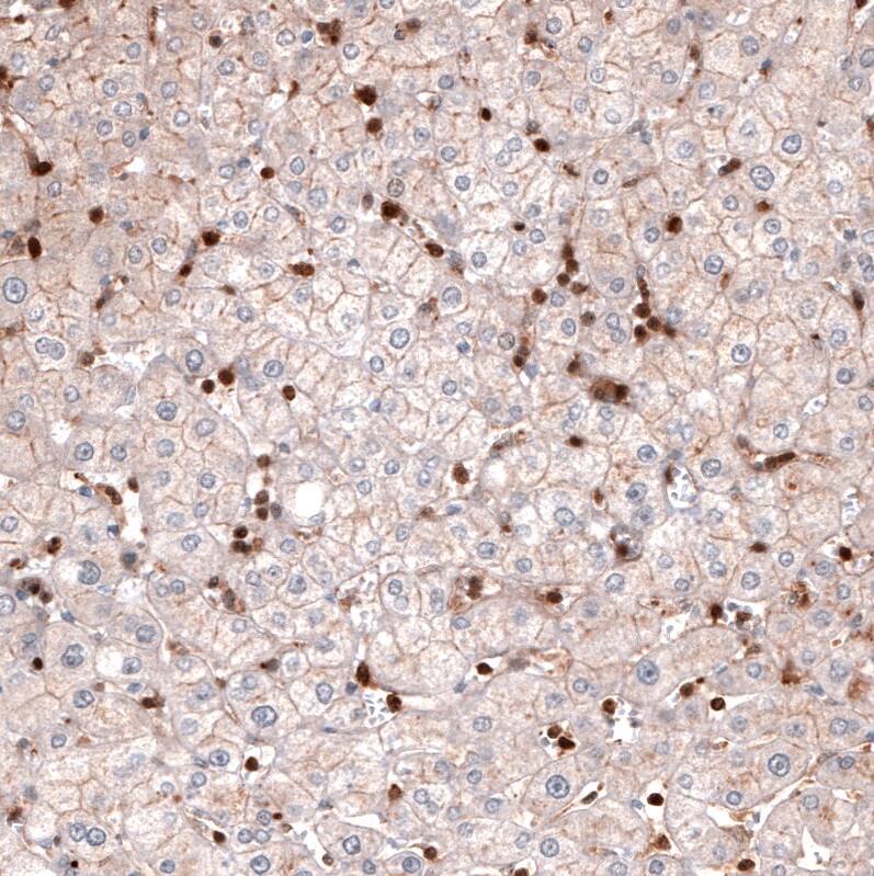 Staining of human liver shows strong cytoplasmic positivity in leukocytes.
