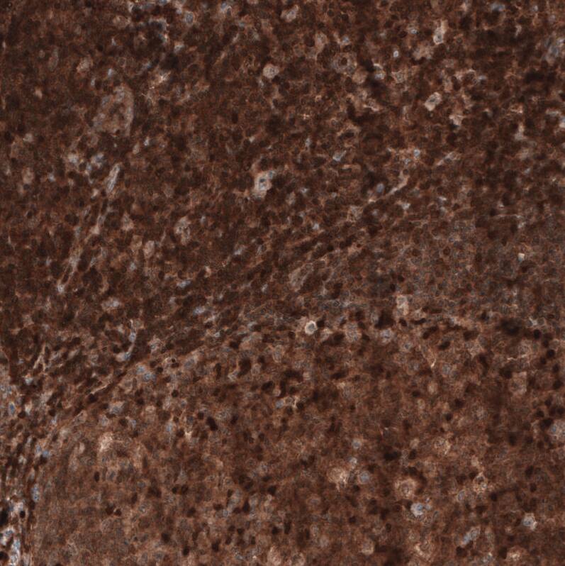 Staining of human tonsil shows strong cytoplasmic positivity in germinal and non-germinal center cells.