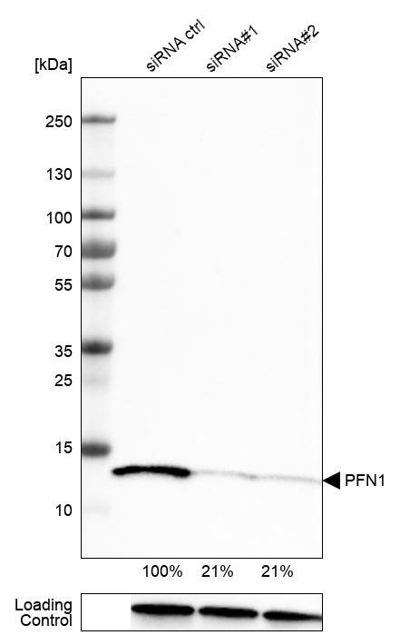 Analysis in U-251MG cells transfected with control siRNA, target specific siRNA probe #1 and #2, using Anti-Profilin 1 antibody. Remaining relative intensity is presented. Loading control: Anti-GAPDH.