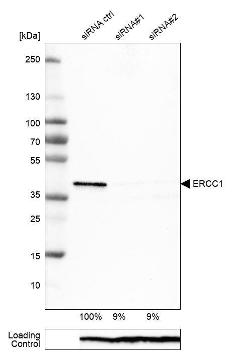 Analysis in U-251MG cells transfected with control siRNA, target specific siRNA probe #1 and #2, using Anti-ERCC1 antibody. Remaining relative intensity is presented. Loading control: Anti-PPIB.