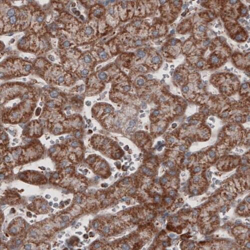 Staining of human liver shows cytoplasmic immunoreactivity in hepatocytes.