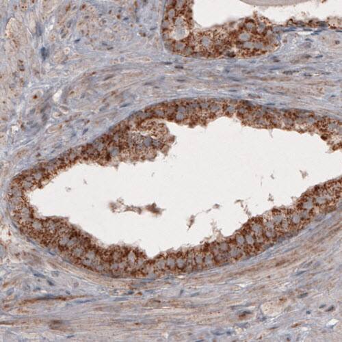 Staining of human prostate shows cytoplasmic positivity in the epithelial cells.