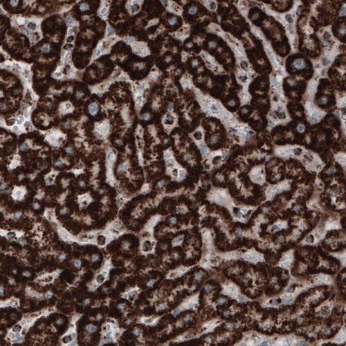 Staining of human liver shows strong cytoplasmic positivity in hepatocytes.