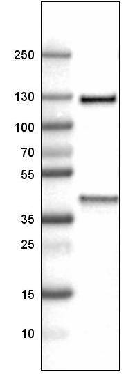 Lane 1: Marker [kDa]Lane 2: Human liver tissue lysate