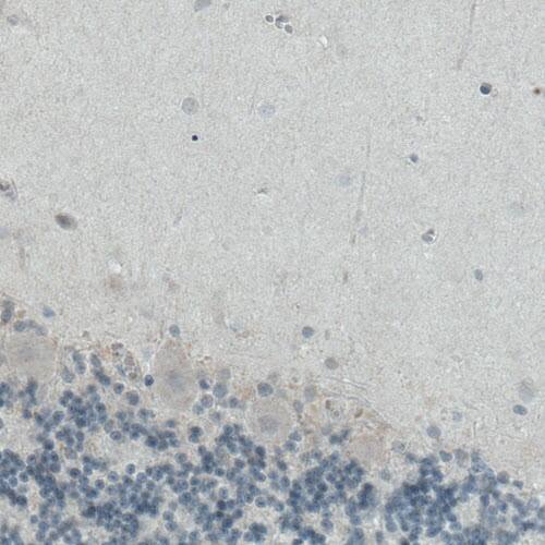 Staining of human cerebellum shows absence of immunoreactivity (negative control).