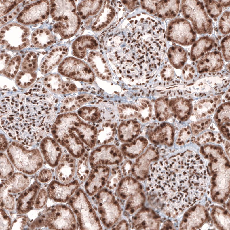 Staining of human kidney shows strong nuclear positivity in cells in glomeruli.