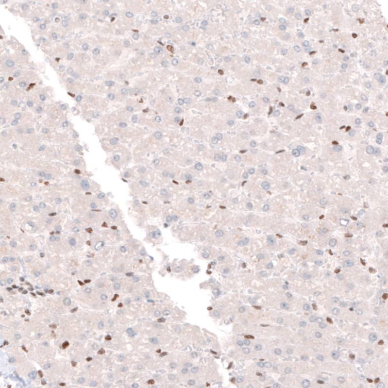 Staining of human liver shows moderate nuclear positivity in leukocytes and no positivity in hepatocytes.