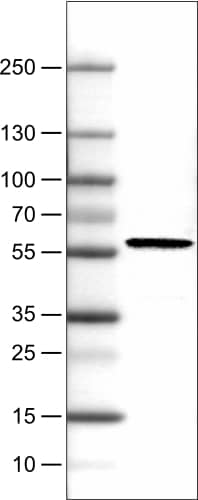 Lane 1: Marker [kDa]Lane 2: Human cell line RT-4