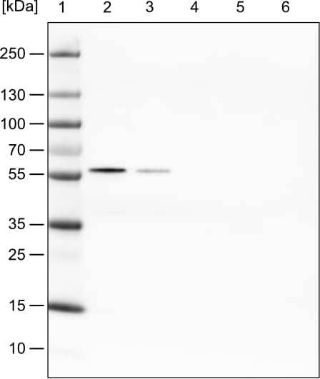 Lane 1: Marker [kDa]Lane 2: Human cell line HeLa cytoplasmic fractionLane 3: Human cell line HeLa membrane fractionLane 4: Human cell line HeLa nuclear fractionLane 5: Human cell line HeLa chromatin fractionLane 6: Human cell line HeLa cytoskeletal fraction