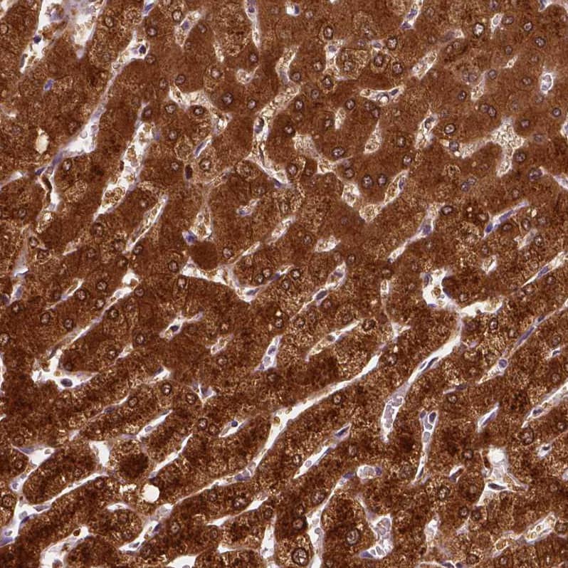 Staining of human liver shows strong cytoplasmic positivity in hepatocytes.