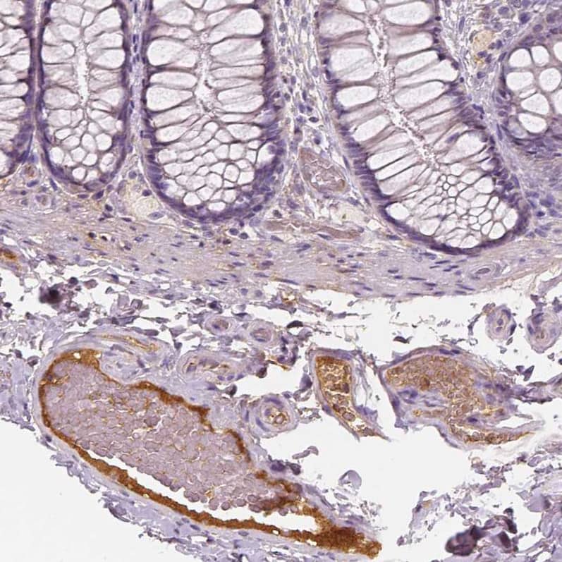 Staining of human colon shows moderate positivity in plasma in blood vessels.