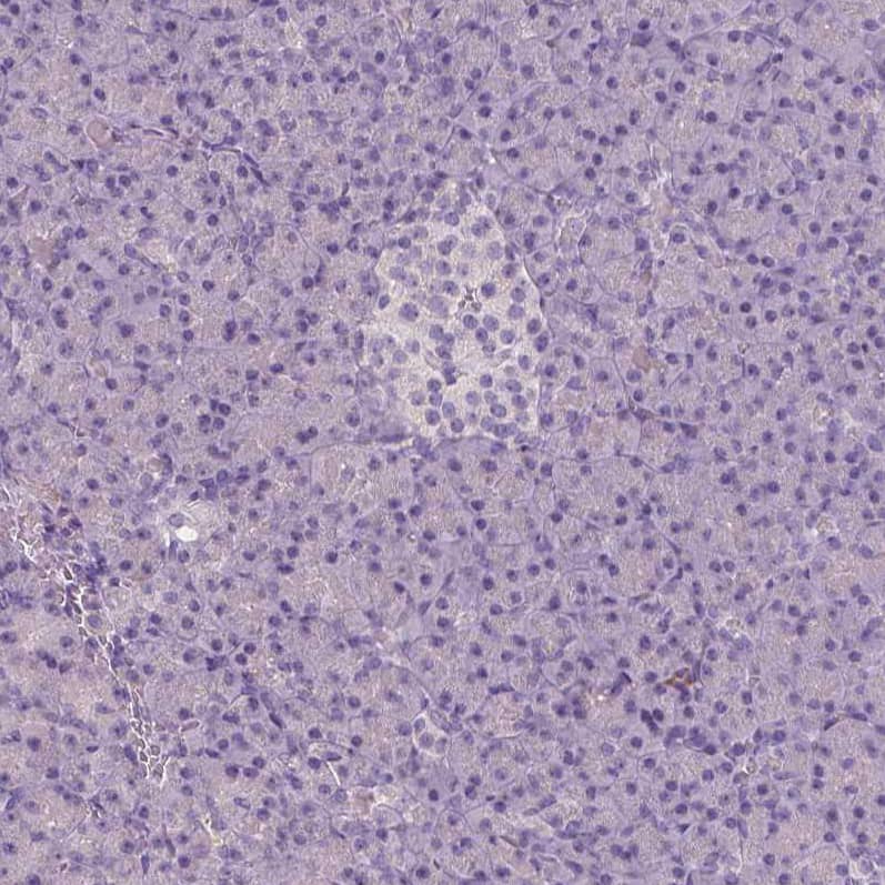 Staining of human pancreas shows no positivity in exocrine glandular cells as expected.