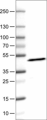 Lane 1: Marker [kDa]Lane 2: Human plasma