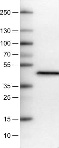 Lane 1: Marker [kDa]Lane 2: Human plasma