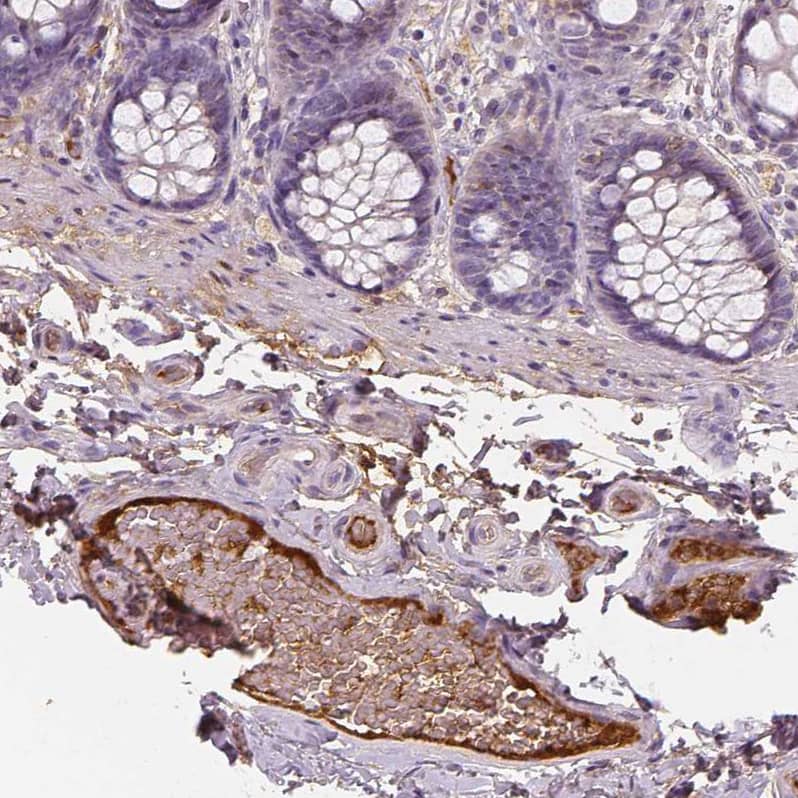 Staining of human colon shows strong positivity in plasma in blood vessels.