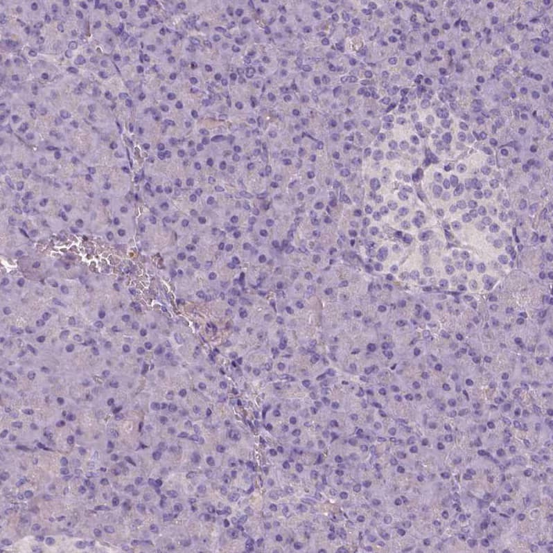 Staining of human pancreas shows no positivity in exocrine glandular cells as expected.