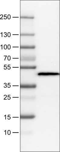 Lane 1: Marker [kDa]Lane 2: Human plasma