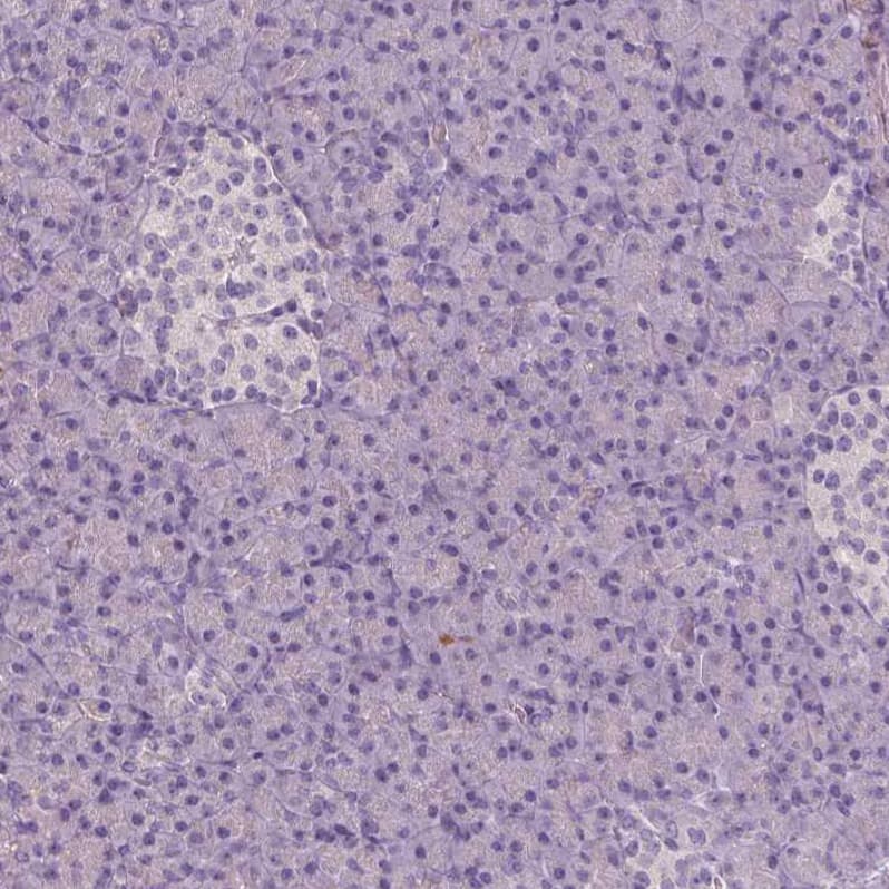 Staining of human pancreas shows no positivity in exocrine glandular cells as expected.