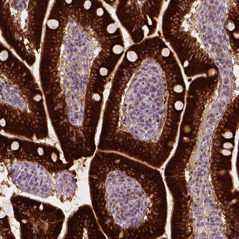 Staining of human small intestine shows strong cytoplasmic positivity in glandular cells.