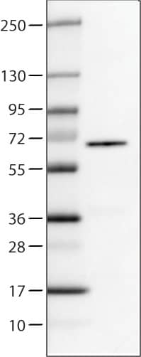 Lane 1: Marker [kDa]Lane 2: Human cell line U-251 MG