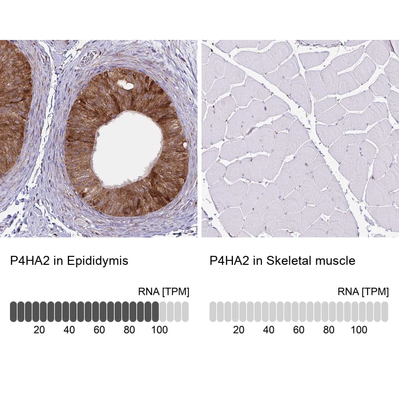 Analysis in human epididymis and skeletal muscle tissues using NBP3-43972 antibody. Corresponding P4HA2 RNA-seq data are presented for the same tissues.