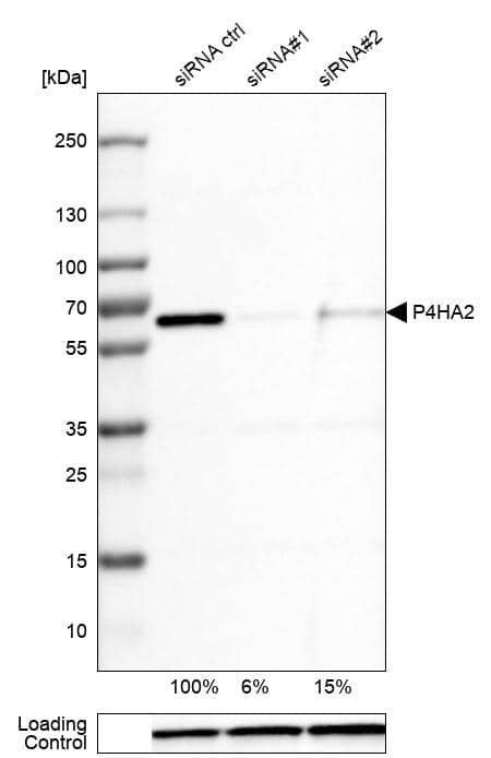 Analysis in U-251MG cells transfected with control siRNA, target specific siRNA probe #1 and #2, using Anti-P4HA2 antibody. Remaining relative intensity is presented. Loading control: Anti-GAPDH.
