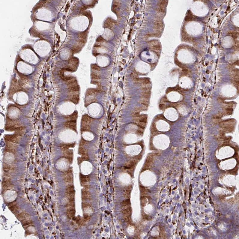 Staining of human small intestine shows moderate cytoplasmic positivity in glandular cells.