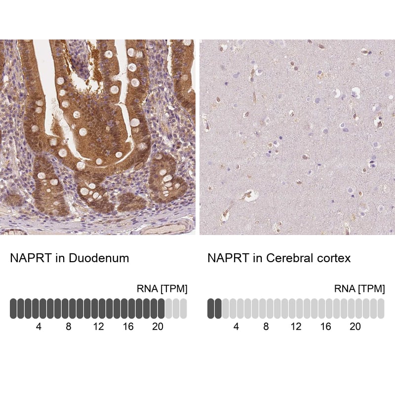 Immunohistochemistry-Paraffin NAPRT1 Antibody (CL0366) - Azide and BSA Free