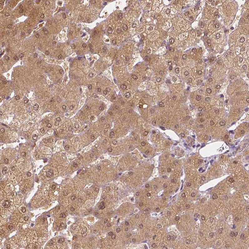 Immunohistochemistry-Paraffin NAPRT1 Antibody (CL0366) - Azide and BSA Free