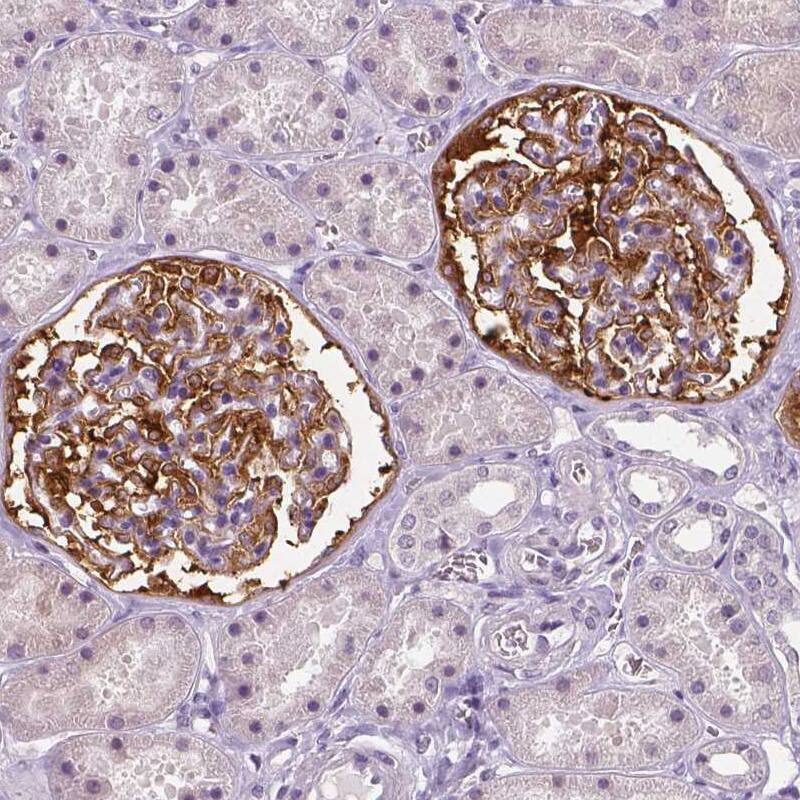 Staining of human kidney shows strong cytoplasmic positivity in cells in glomeruli.