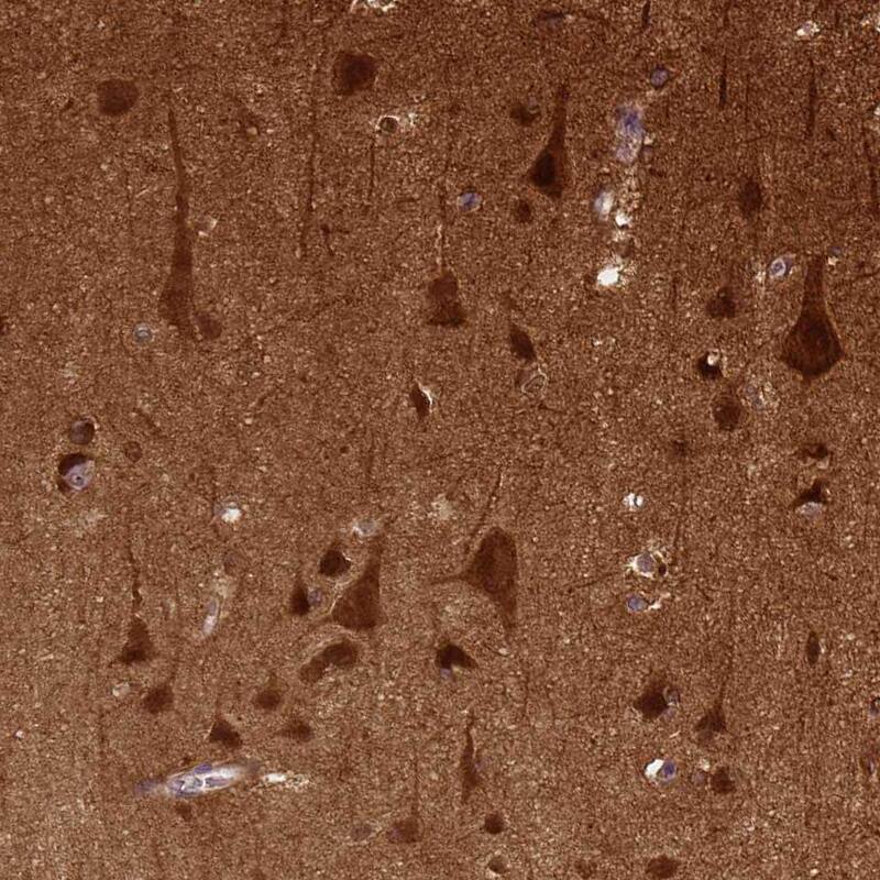 Staining of human cerebral cortex shows strong cytoplasmic positivity in neurons.