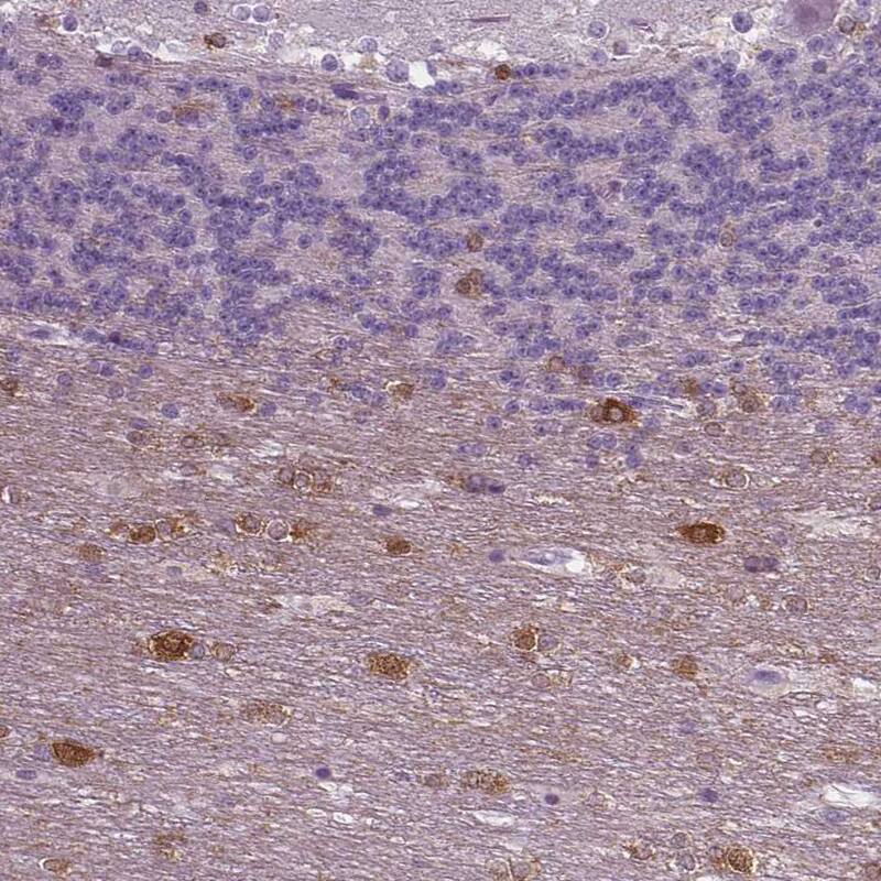 Staining of human cerebellum shows moderate cytoplasmic positivity in neurons.