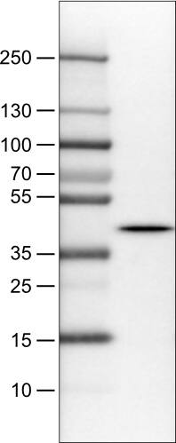 Lane 1: Marker [kDa]Lane 2: Human cerebral cortex lysate